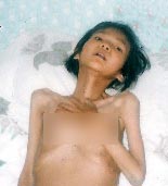 杨苏红被折磨得皮包骨头,奄奄一息后放回家